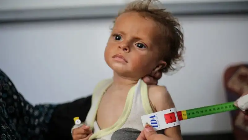 İngiltere, 300 Gazzeli Çocuğu Ülkesine Davet Ediyor