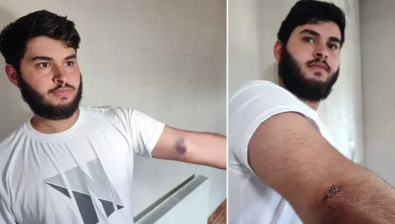 Bahçeye Kaçan Top, Mahallede Büyük Kaosa Neden Oldu!